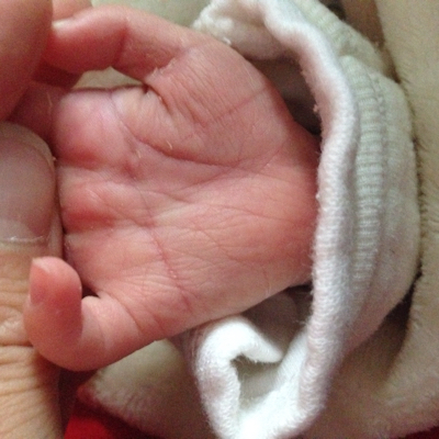 婴儿的手纹(婴儿的手纹是断掌怎么回事)