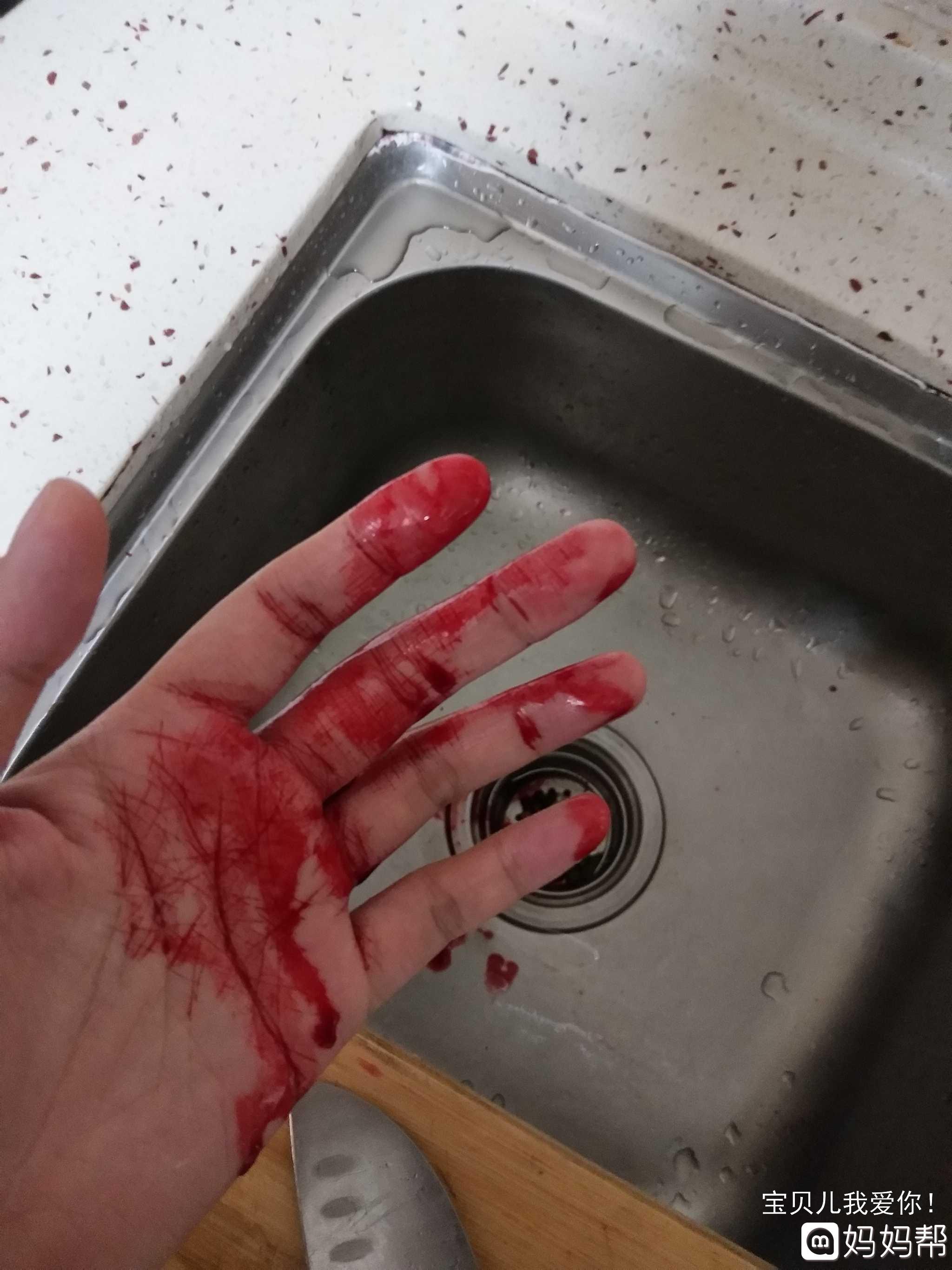 手被割流血的图片图片