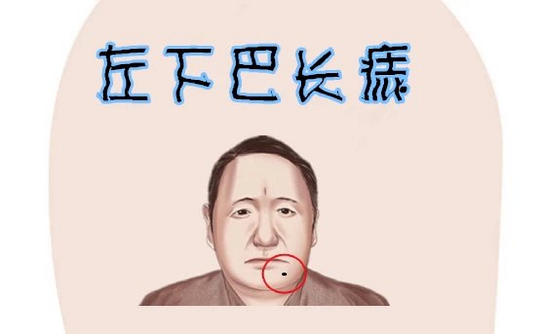 下巴唇长痣