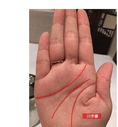 什么是川字纹普遍的掌纹是感情线与智慧线生命线在手掌拇指与食指中间