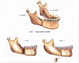 下巴正常骨图(正常下巴骨骼图片)