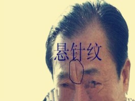 男人天柱纹和悬针纹的区别(悬针纹与天柱纹的天柱纹的图片)