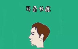 左耳上方头发内有痣(左耳上方有痣的男人代表什么)