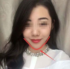 嘴角长扬尖下巴的女人(嘴角长扬尖下巴的女人好不好)